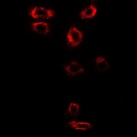 Anti-Syntenin Antibody