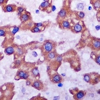 Anti-SDHA Antibody