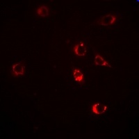 Anti-HSP47 Antibody