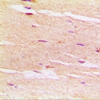 Anti-delta-Sarcoglycan Antibody