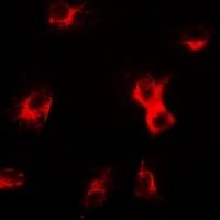 Anti-delta-Sarcoglycan Antibody