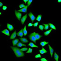 Anti-SH3GL2 Antibody