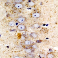 Anti-Sigma1 Receptor Antibody
