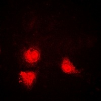 Anti-SIRT1 Antibody