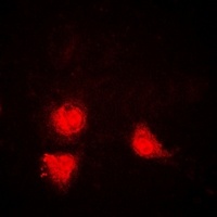 SIRT1 antibody