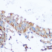 Anti-SIRT4 Antibody