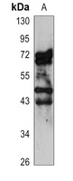 CD319 Rabbit Polyclonal Antibody