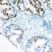 Anti-BRG1 Antibody