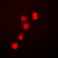 Anti-BRG1 Antibody