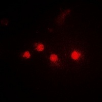 Anti-SMARCAD1 Antibody