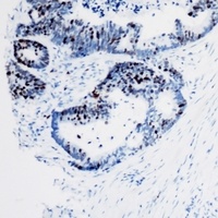 SMARCE1 antibody