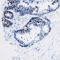 Anti-BAF57 Antibody