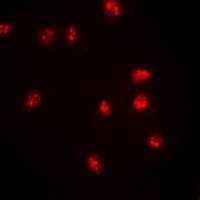 Anti-BAF57 Antibody