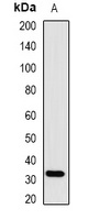 SMN Rabbit Polyclonal Antibody