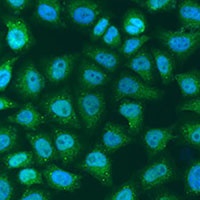 SOCS4 antibody