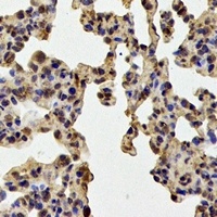 SOD2 Antibody