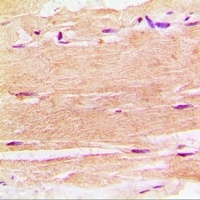 Anti-SPHK1 Antibody