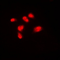 Anti-SPHK1 Antibody