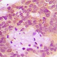 Anti-HAI-1 Antibody