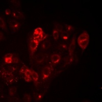 Anti-HAI-1 Antibody