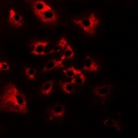 Anti-HAI-2 Antibody