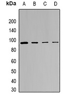 SRPK1 Rabbit Polyclonal Antibody