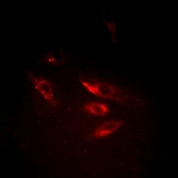Anti-SRPK1 Antibody