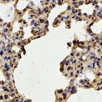 Anti-STIP1 Antibody