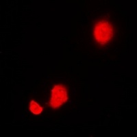 Anti-STIP1 Antibody