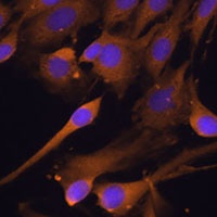 Anti-CHIP Antibody