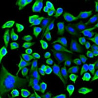 TAB1 Antibody