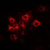 Anti-Tapasin Antibody