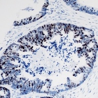 Anti-TIA1 Antibody