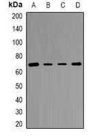 Transketolase Rabbit Polyclonal Antibody