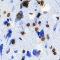 Anti-Transketolase Antibody