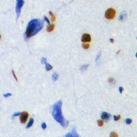 Anti-Thymopoietin Antibody