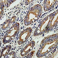 Anti-TNNC2 Antibody