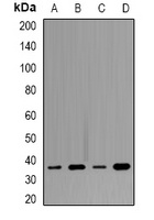 Tropomyosin Antibody