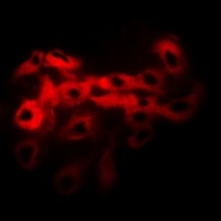 Anti-Tropomyosin Antibody