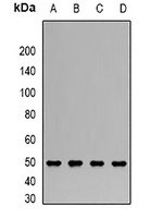 CLN2 Rabbit Polyclonal Antibody