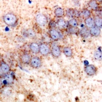Anti-HSP75 Antibody