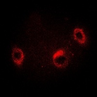 Anti-HSP75 Antibody