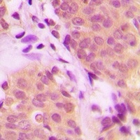 Anti-RNF81 Antibody