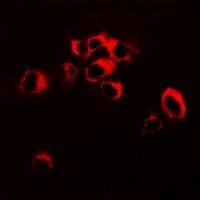 Anti-RNF81 Antibody