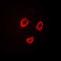 Anti-TRPV5 Antibody