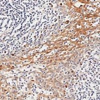 Anti-GILZ Antibody