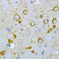 Anti-TSHR Antibody