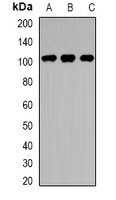 TTK Rabbit Polyclonal Antibody