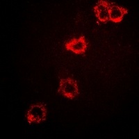 Anti-STS-1 Antibody