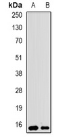 UBCH5 Antibody